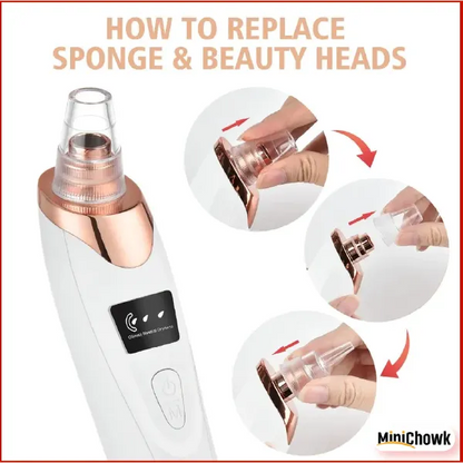 ✨ 5-in-1 Pro Blackhead Remover | Deep Pore Vacuum Cleanser SwagAura