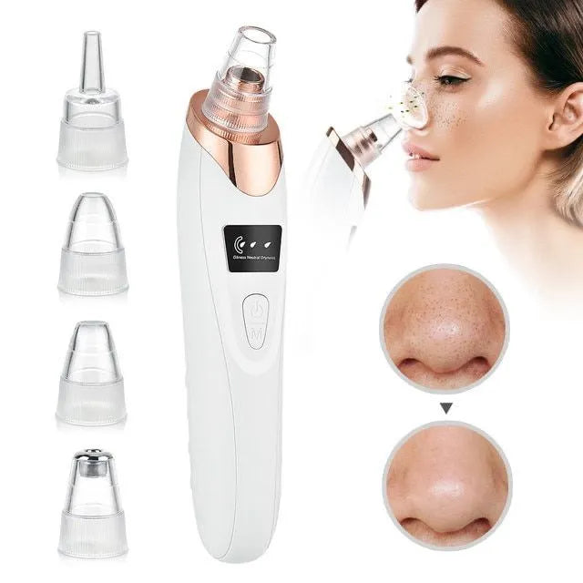 ✨ 5-in-1 Pro Blackhead Remover | Deep Pore Vacuum Cleanser SwagAura
