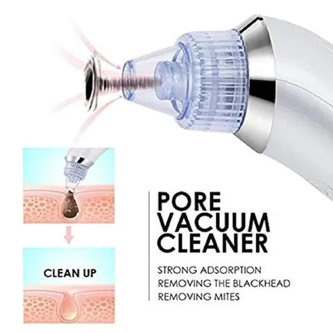 ✨ 5-in-1 Pro Blackhead Remover | Deep Pore Vacuum Cleanser SwagAura