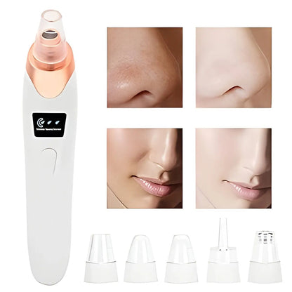 ✨ 5-in-1 Pro Blackhead Remover | Deep Pore Vacuum Cleanser SwagAura